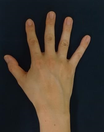 手DSC03304